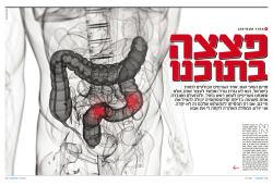 סרטן המעי הגס, אחד הגורמים הבולטים למוות בישראל, הוא לא גזרת - G-EYE