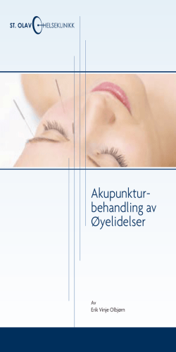 Akupunktur- behandling av Øyelidelser