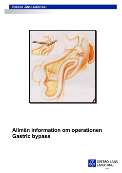 Allmän information om operationen Gastric bypass