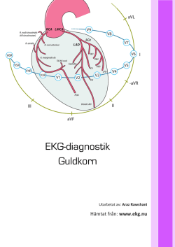 EKG-diagnostik lathund.pdf