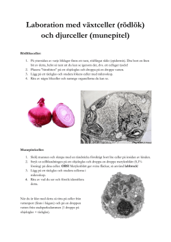 Laboration med växtceller (rödlök) och djurceller (munepitel)