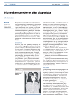 Bilateral pneumothorax efter akupunktur