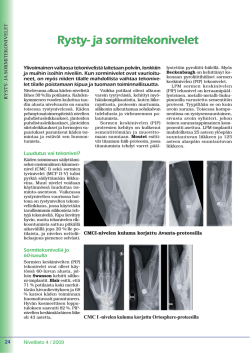 Artikkeli: Rysty- ja sormitekonivelet