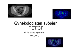 Gynekologisten syöpien PET/CT