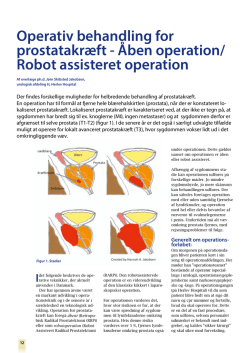 Robot assisteret operation