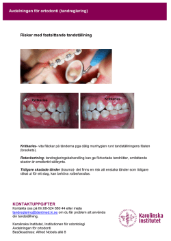 Risker med fastsittande tandställning