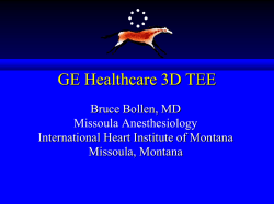 GE Healthcare 3D TEE