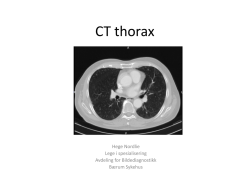CT thorax - Vestre Viken