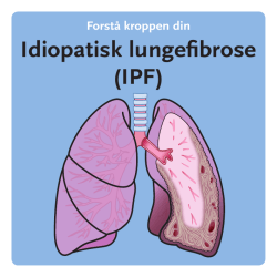 Idiopatisk lungefibrose (IPF)