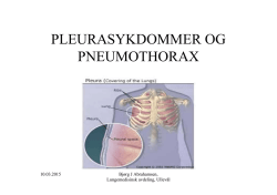 pleurasykdommer og pneumothorax