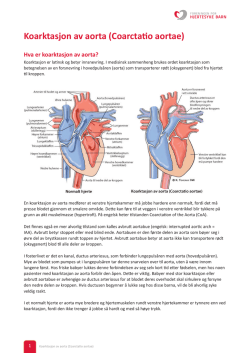 Koarktasjon av aorta (Coarctatio aortae)