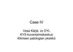Case IV