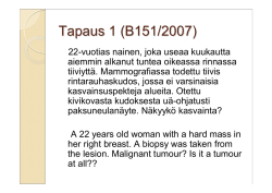 Tapaus 1 (B151/2007)